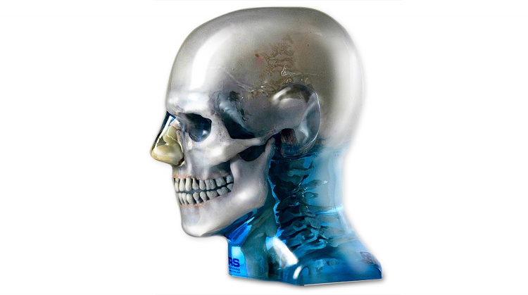 CIRS 711-HN頭部模體，CIRS 711-HN CBCT模體