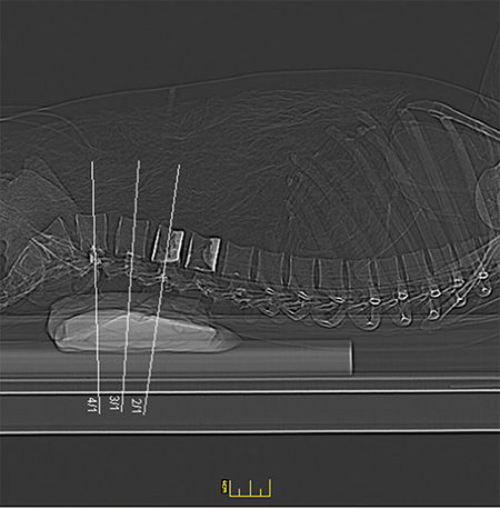 德國Erler Zimmer 7200天然骨骼全身模體，EZ 7200全身模體