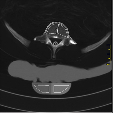 德國Erler Zimmer 7200天然骨骼全身模體，EZ 7200全身模體