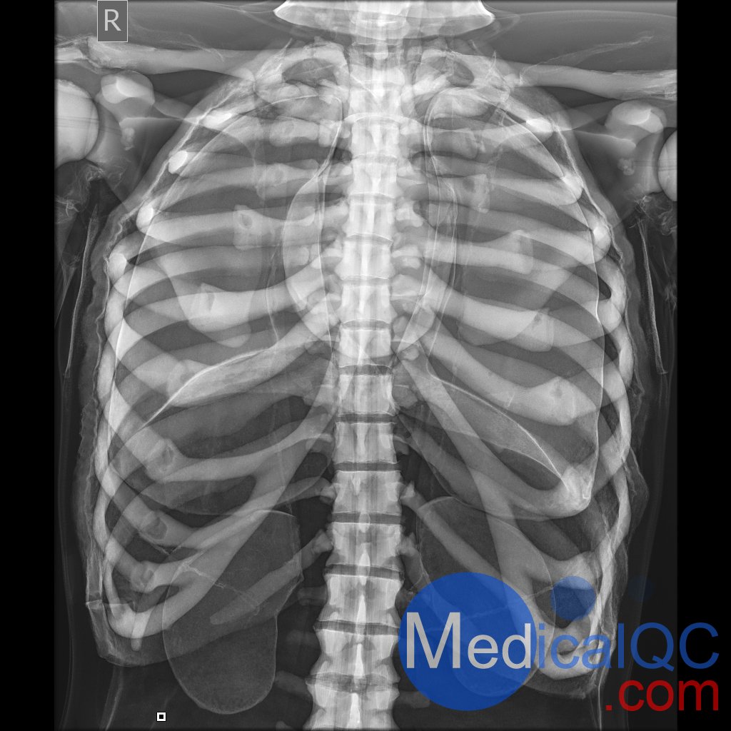 AR10A全身X射線照相定位模體，AR10A全身模體，AR10A X射線成像模體