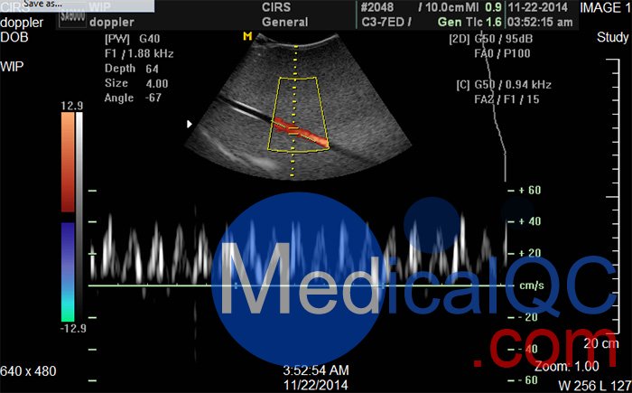 CIRS 769多普勒流量泵，CIRS 769血流測試系統(tǒng)
