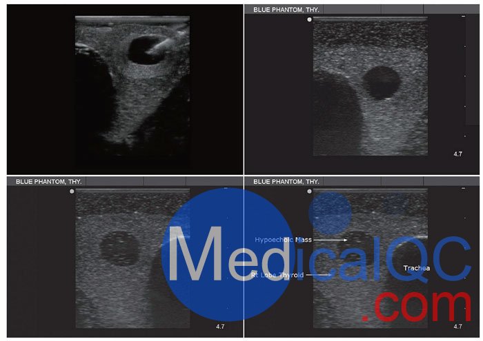 BPT195甲狀腺穿刺模型，BPT195超聲引導(dǎo)穿刺模體影像圖