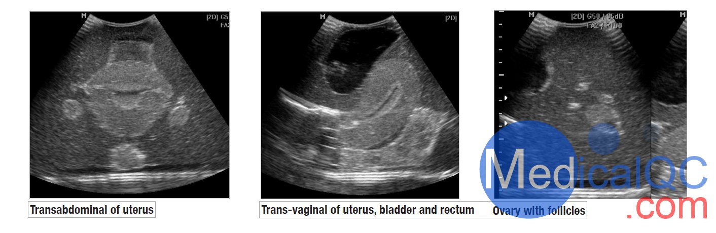 CIrs 404A女性盆腔模體，CIrs 404A超聲訓(xùn)練骨盆模體影像圖