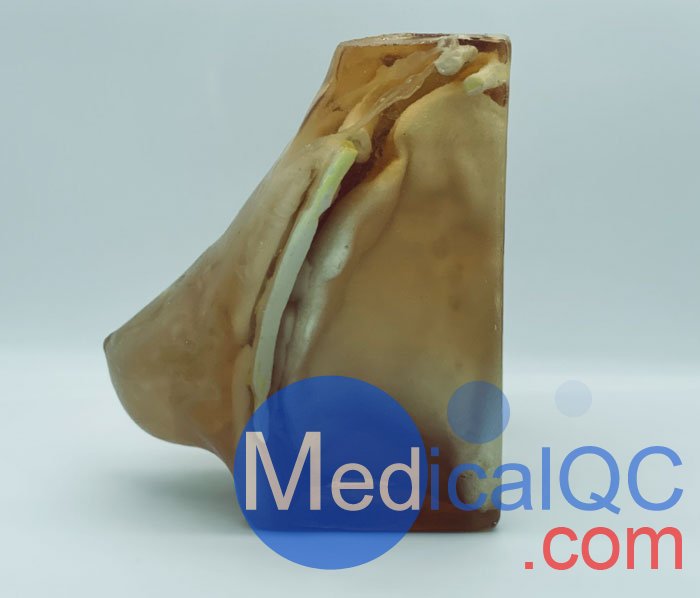 BT-A02乳腺模體,BT-A02成人乳腺模型產(chǎn)品實(shí)拍圖