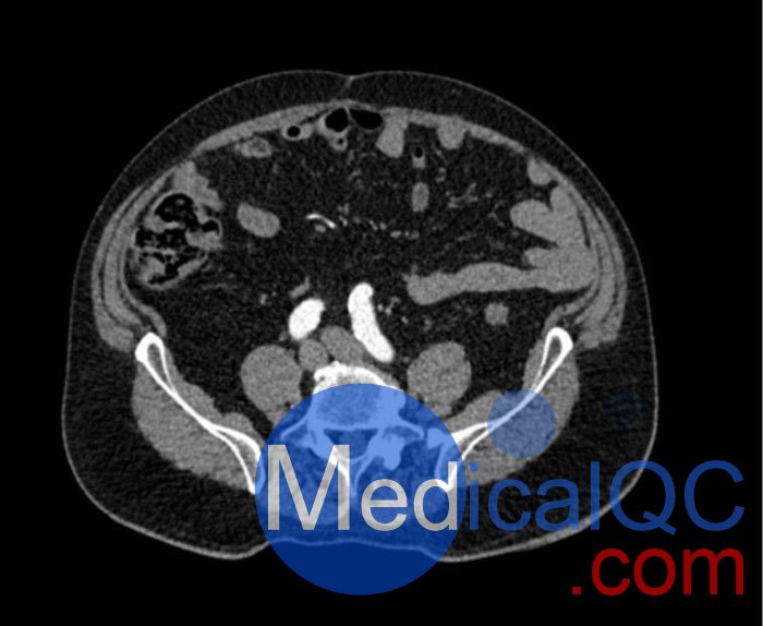 WEK53-05腹部模體，WEK53-05動(dòng)脈瘤腹部模體