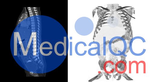 WEK58-03兒童軀干模型，WEK58-03兒童軀干模體