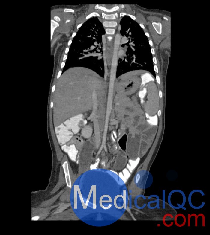 WEK58-03兒童軀干模型，WEK58-03兒童軀干模體成像效果圖