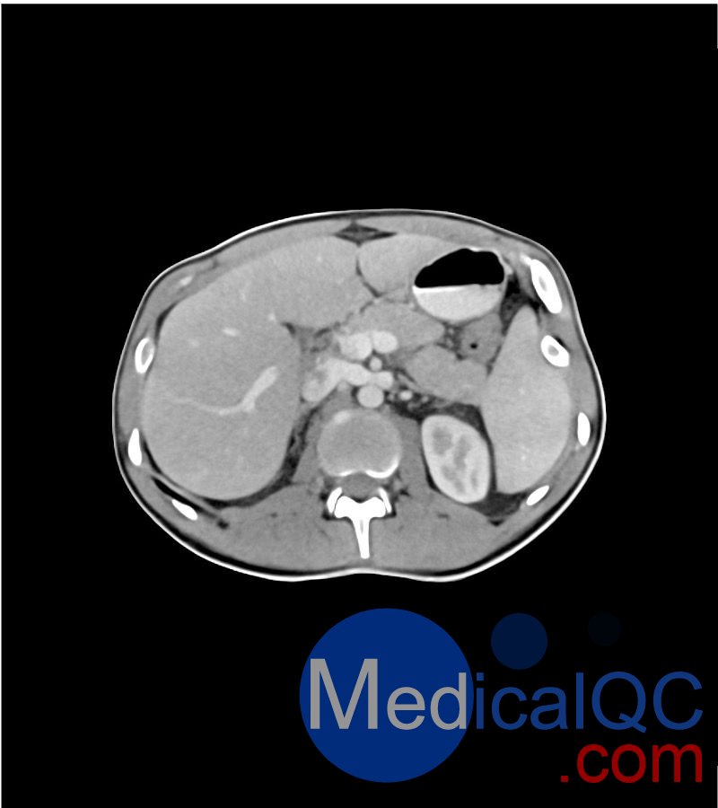 WEK-5501男性腹部模體，WEK-5501男性骨盤模體